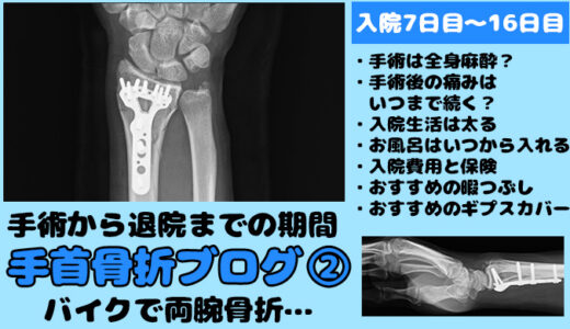 手首骨折ブログその4 1ヶ月目 2ヶ月目 ギプスを外して自宅療養リハビリ期間 Ct125ハンターカブのカスタムブログ