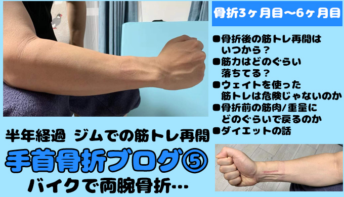 手首骨折ブログ日記その5 3ヶ月目 6ヶ月目 いつからジムでの筋トレ運動を再開したか 半年経過 Ct125ハンターカブのカスタムブログ